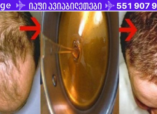 მკურნალობა გამელოტების წინააღმდეგ. საოცარი რეცეპტი: 2 დღის შემდეგ თქვენი თმა დაიწყებს ზრდას!