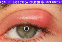 თვალის ქუთუთოების ანთება: ბლეფარიტის მკურნალობა ხალხური საშუალებებით