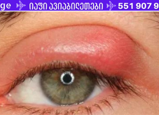 თვალის ქუთუთოების ანთება: ბლეფარიტის მკურნალობა ხალხური საშუალებებით