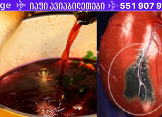 ცნობილი უძველესი რეცეპტი დაგეხმარება განკურნოთ ნებისმიერი გულის პრობლემა!