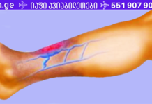 იტანჯებით სისხლის ცუდი მიმოქცევით? აი, როგორ მოაგვაროთ პრობლემა სულ რაღაც 7 წუთში!