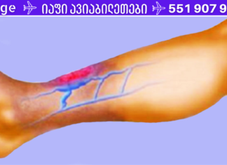 იტანჯებით სისხლის ცუდი მიმოქცევით? აი, როგორ მოაგვაროთ პრობლემა სულ რაღაც 7 წუთში!