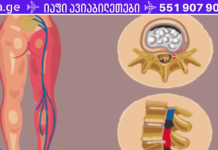 რეცეპტი იშხიაზის სამკურნალოდ და ტკივილის გასაყუჩებლად! ეს ჩაი ჩემი ხსნაა . .