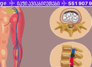 რეცეპტი იშხიაზის სამკურნალოდ და ტკივილის გასაყუჩებლად! ეს ჩაი ჩემი ხსნაა . .