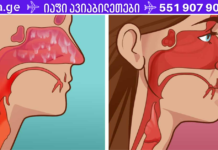 მოკალი ყველა სინუსური ინფექცია სულ რაღაც 20 წამში!