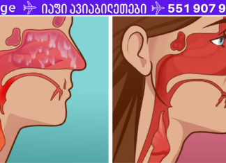 მოკალი ყველა სინუსური ინფექცია სულ რაღაც 20 წამში!
