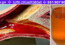 დახშული არტერიების გამო გულის საკმაოდ სერიოზული პრობლემები შემექმნა, მაგრამ ეს ჯადოსნური სასმელი დამეხმარა მათ გაწმენდაში!