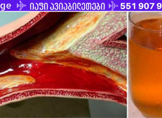 დახშული არტერიების გამო  გულის საკმაოდ სერიოზული პრობლემები შემექმნა, მაგრამ ეს ჯადოსნური სასმელი დამეხმარა მათ გაწმენდაში!