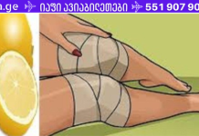 აი, როგორ გამოვიყენოთ ლიმონი მუხლის ტკივილის შესამსუბუქებლად, თან სახლის პირობებში!!