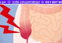 აპენდიციტის 5 უტყუარი ნიშანი, რომელიც არ უნდა უგულებელყოთ. .!