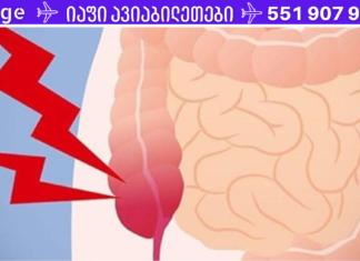 აპენდიციტის 5 უტყუარი ნიშანი, რომელიც არ უნდა უგულებელყოთ. .!