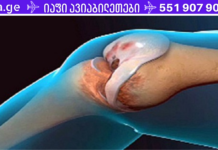 შემდეგი რეცეპტი აუმჯობესებს ძვლის სტრუქტურას და აღადგენს სახსრებისა და მუხლების ნორმალურ ფუნქციონირებას!