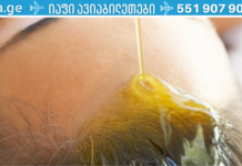 ჯადოსნური შამპუნი: შედეგად თმა ძალიან სწრაფად გაგეზრდებათ. ვისარუნდა სქელი ბზინვარე და ძლიერი თმა, არა? ეს ყველაფერი მიღწევადია. .