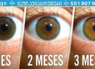 ბუნებრივი რეცეპტი კატარაქტის დასამარცხებლად და მხედველობის გასაუმჯობესებლად სულ რაღაც 3 თვეში! ეს ძალიან მარტივია! მოერიდეთ ქირურგიულ ჩარევას!