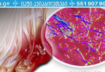 ეს ბუნებრივი ინგრედიენტი დაგეხმარებათ შარდის მჟავის დაქვეითებაში და სახსრების ტკივილთან ბრძოლაში!