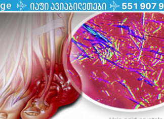 ეს ბუნებრივი ინგრედიენტი დაგეხმარებათ შარდის მჟავის დაქვეითებაში და სახსრების ტკივილთან ბრძოლაში!