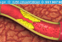 ყოველ დილით ამ სასმელის მხოლოდ 4 სუფრის კოვზის მიღებით დაემშვიდობეთ დახშულ არტერიებს, მაღალ არტერიულ წნევას და ცუდ ქოლესტერინს !