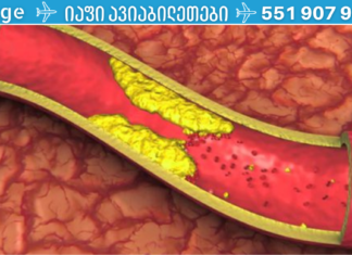 ყოველ დილით ამ სასმელის მხოლოდ 4 სუფრის კოვზის მიღებით დაემშვიდობეთ დახშულ არტერიებს, მაღალ არტერიულ წნევას და ცუდ ქოლესტერინს !
