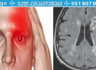 11 სახიფათო ნიშანი იმისა, რომ თქვენ “ჩუმი” ინსულტი გადაიტანეთ ან შესაძლოა მალე დაგემართოთ ასე. .