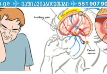 როგორ შევაჩეროთ მყისიერად შაკიკის შეტევა? თან მხოლოდ მარილის გამოყენებით. .