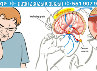როგორ შევაჩეროთ მყისიერად შაკიკის შეტევა? თან მხოლოდ მარილის გამოყენებით. .