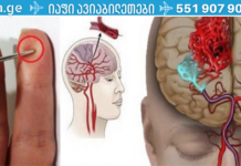 ინსულტის შემთხვევაში, შენს სიცოცხლეს ნემსი გადაარჩენს! ნახეთ, როგორ გაუწიოთ პირველადი დახმარება ინსულტის დროს!