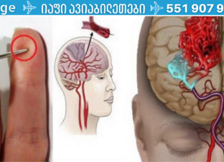 ინსულტის შემთხვევაში, შენს სიცოცხლეს ნემსი გადაარჩენს! ნახეთ, როგორ გაუწიოთ პირველადი დახმარება ინსულტის დროს!