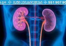 ინფორმაცია რომელსაც აუცილებლად უნდა ფლობდეთ! 10 ადრეული სიმპტომი: გაგაფრთხილებთ თირკმელების პრობლემებზე