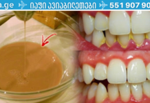 ძლიერი ხელნაკეთი პირის ღრუს სავლები საშუალება, რომელიც აშორებს ნადებს სულ რაღაც 2 წუთში