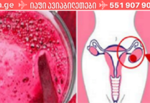 როგორ ვებრძოლოთ საკვერცხის ცისტებსა და მიომას ბუნებრივად! ეს ᲣᲜᲓᲐ ᲬᲐᲘᲙᲘᲗᲮᲝ!