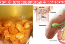 მეცნიერებმა ღვიძლის გაწმენდის საუკეთესო საშუალება აღმოაჩინეს!