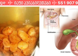 მეცნიერებმა ღვიძლის გაწმენდის საუკეთესო საშუალება აღმოაჩინეს!