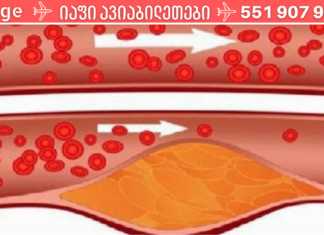მხოლოდ 4 სუფრის კოვზი ამ სასმელიდან და დაივიწყებთ მაღალ წნევას და მაღალ ქოლესტერინს!