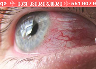 ალბათ არა ერთხელ გქონიათ თვალები გაღიზიანებული, შესაბამისად დაგაინტერესებთ მისი მკურნალობის ბუნებრივი საშუალებებით, არა? მაშინ, სრულად გაეცანით ინფორმაციას. .