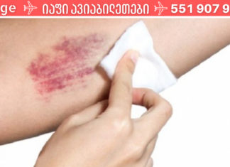 8 ხალხური მეთოდი სისხლჩაქცევებისგან თავის დასაღწევად!