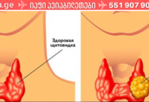 შეამოწმეთ ფარისებრი ჯირკვალი სახლში ამ მარტივი ტესტის დახმარებით!