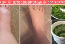 ყველაზე ძლიერი, ბუნებრივი საშუალება შეშუპებული ფეხებისთვის!