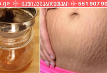 მოიშორეთ სტრიები ამ 7 გასაოცარი მეთოდის დახმარებით. .!