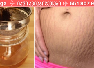 მოიშორეთ სტრიები ამ 7 გასაოცარი მეთოდის დახმარებით. .!