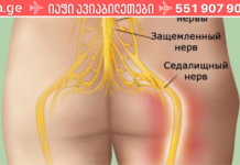 დაემშვიდობეთ ზურგის ტკივილს! წარმატების მიღწევა 95% შემთხვევაში გარანტირებულია!