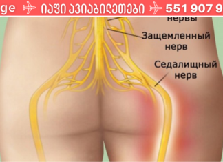 დაემშვიდობეთ ზურგის ტკივილს! წარმატების მიღწევა 95% შემთხვევაში გარანტირებულია!