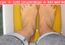 პრობლემის მოსაგვარებლად მან ვაშლის ძმრით ფეხის აბაზანა მიიღო. წარმოდგენა არ მქონდა ასეთ ეფექტური თუ იყო ეს მეთოდი!