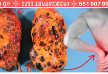 8 ცუდი ჩვევა, რამაც შეიძლება გამოიწვიოს თირკმელების დაზიანება. დაუყოვნებლივ უნდა დაიწყოთ მათი თავიდან აცილება!