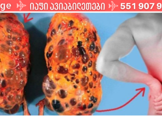 8 ცუდი ჩვევა, რამაც შეიძლება გამოიწვიოს თირკმელების დაზიანება. დაუყოვნებლივ უნდა დაიწყოთ მათი თავიდან აცილება!