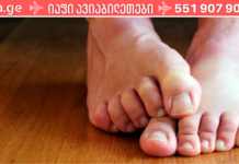 მეგობრებო სოკავან ინფექციას უკან დავახევინე! ქავილი, გაყვითლებული ფრჩხილები და უსიამოვნო სუნი კი სამუდამოდ წარსულში მოვიტოვე. .