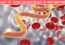 სხეულის გაფრთხილება, როდესაც მასში სხვადასხვა სახის პარაზიტები ბინადრობენ! განსაკუთრებით მშობლებმა ეს უნდა იცოდეთ. .