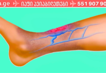 თუ სისხლის მიმოქცევის შეფერხება გაწუხებთ, დაუთმეთ დღეში რამდენიმე წუთი ამ მარტივ პროცედურას, რათა პრობლემა მალევე აღმოიფხვრას. .