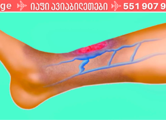 თუ სისხლის მიმოქცევის შეფერხება გაწუხებთ, დაუთმეთ დღეში რამდენიმე წუთი ამ მარტივ პროცედურას, რათა პრობლემა მალევე აღმოიფხვრას. .