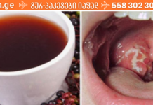 ყელის სტრეპტოკოკი: 10 ნატურალური საშუალება, რომელიც პრობლემის გადასაჭრელად გამოგადგებათ