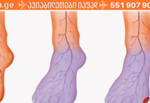 დიახ, თქვენ შეგიძლიათ გააუმჯობესოთ სისხლის ცუდი მიმოქცევა და მათ შორის აღმოფხვრათ “ცივი ფეხების” პრობლემა!!